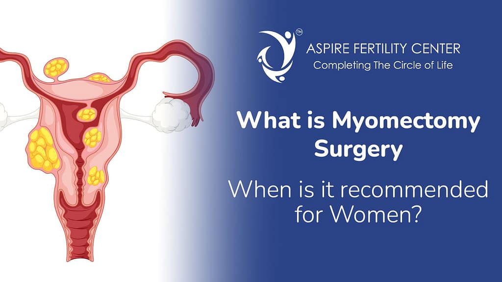 What Is Myomectomy Surgery and When Is It Recommended for Women? Myomectomy Surgery