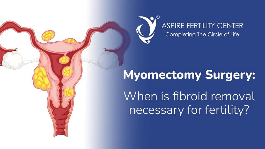 Myomectomy Surgery: When Is Fibroid Removal Necessary for Fertility? Myomectomy