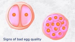 Fertility Articles 1 Signs of Poor Egg Quality - Unveiling Symptoms and Causes