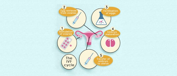 How does IVF Work – An Overview How does IVF Work – An Overview