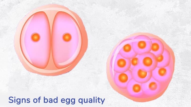 Signs of Poor Egg Quality - Unveiling Symptoms and Causes Signs of Poor Egg Quality - Unveiling Symptoms and Causes